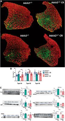 Calorie Restriction Rescues Mitochondrial Dysfunction in Adck2-Deficient Skeletal Muscle